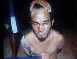 Diduga Dianiaya Usai Diamankan, Istri Warga Rumpis Tuntut Keadilan